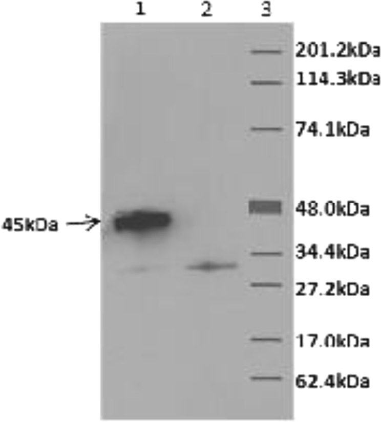 In vitro spleen cell cytokine responses of adult mice immunized with a recombinant PorA (major outer membrane protein [MOMP]) from Campylobacter jejuni.